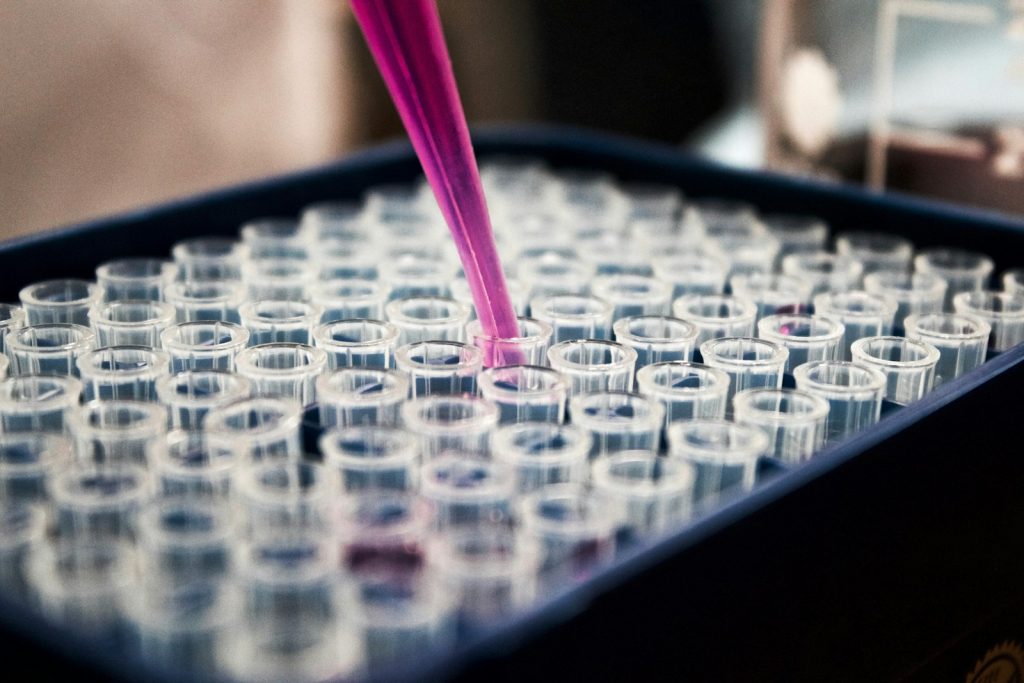 Pipette above laboratory tubes during blood testing